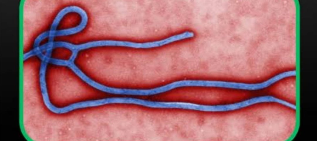 Sud-Kivu : trois (3) cas confirmés d’Ebola, une dizaine d’autres suspects signalés